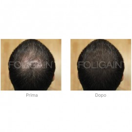 Foligain F5 Minoxidil 5% Uomo 60ml